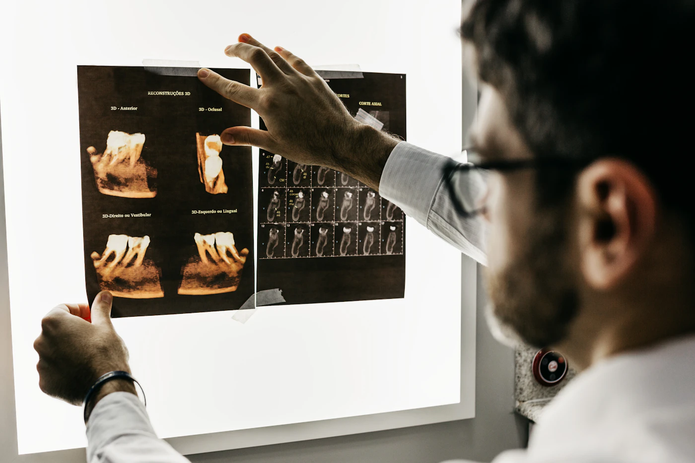 Dentist reviewing dental X-rays on a light box