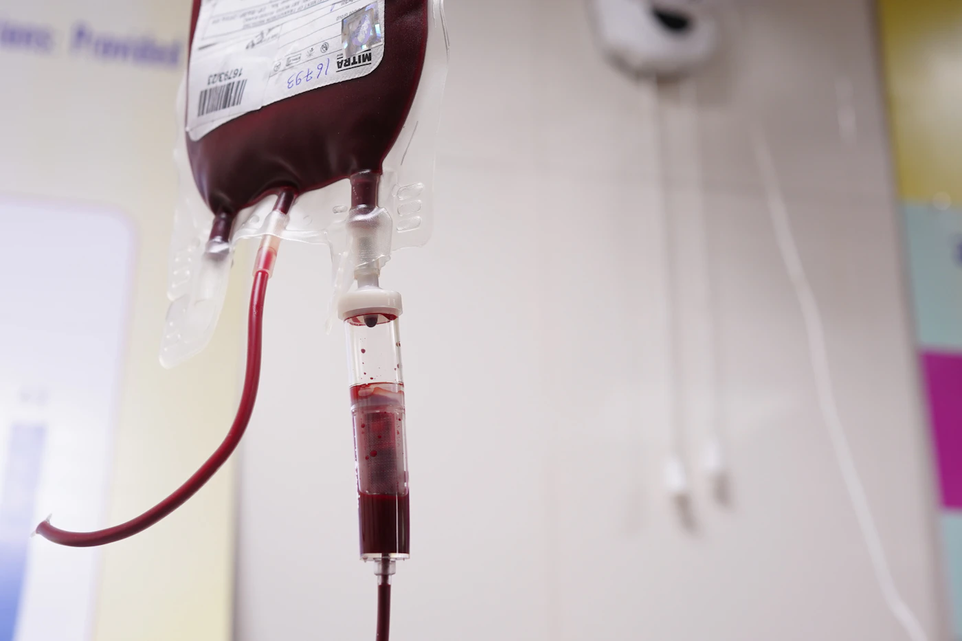 Bag of blood hanging from a drip chamber during a transfusion