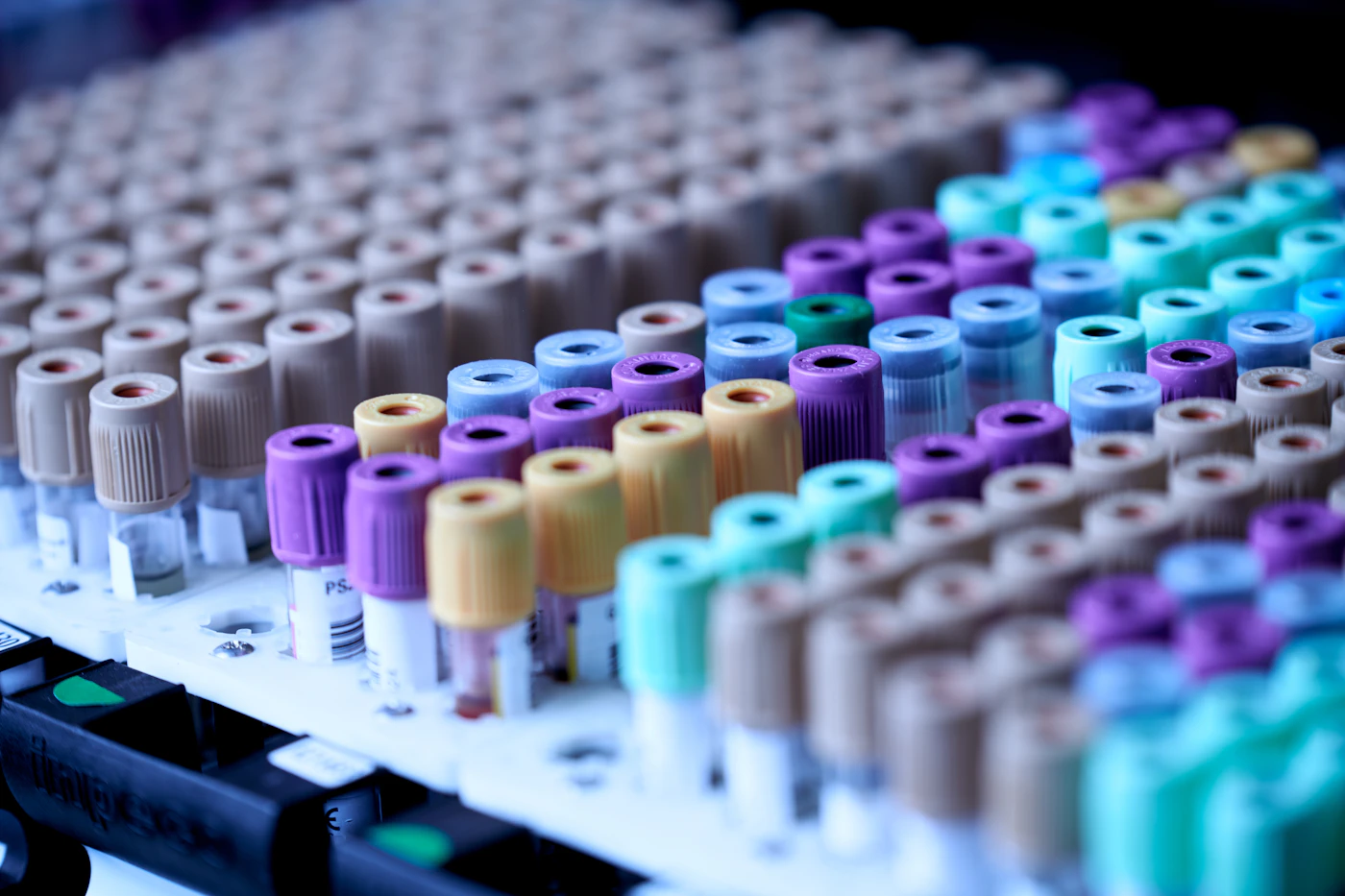 Rows of blood collection tubes with colored caps in a laboratory rack