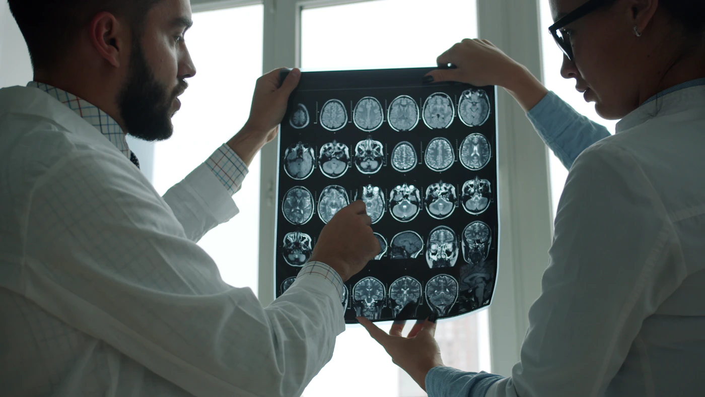 Two physicians reviewing a sheet of brain MRI images